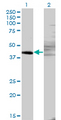 ZNF193 Antibody - Western Blot analysis of ZNF193 expression in transfected 293T cell line by ZNF193 monoclonal antibody (M06), clone 3G6.Lane 1: ZNF193 transfected lysate(46 KDa).Lane 2: Non-transfected lysate.