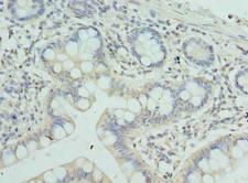 ZNF193 Antibody - Immunohistochemistry of paraffin-embedded human small intestine tissue using antibody at dilution of 1:100.