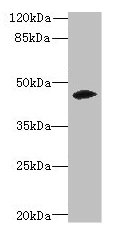 ZNF193 Antibody - Western blot All lanes: ZSCAN9 antibody at 0.3µg/ml + Mouse brain tissue Secondary Goat polyclonal to rabbit IgG at 1/10000 dilution Predicted band size: 46, 52 kDa Observed band size: 46 kDa