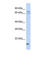 ZNF195 Antibody - Western blot of Human HepG2. ZNF195 antibody dilution 1.0 ug/ml.  This image was taken for the unconjugated form of this product. Other forms have not been tested.