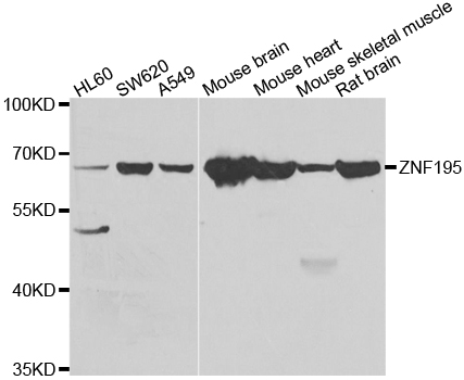 ZNF195 Antibody - Western blot analysis of extracts of various cell lines.