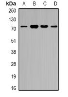 ZNF195 Antibody - Western blot analysis of ZNF195 expression in SW620 (A); A549 (B); mouse heart (C); rat brain (D) whole cell lysates.