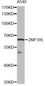 ZNF195 Antibody - Western blot analysis of extracts of A549 cells, using ZNF195 antibody at 1:1000 dilution. The secondary antibody used was an HRP Goat Anti-Rabbit IgG (H+L) at 1:10000 dilution. Lysates were loaded 25ug per lane and 3% nonfat dry milk in TBST was used for blocking. An ECL Kit was used for detection and the exposure time was 90s.