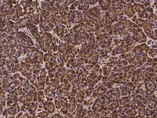 ZNF195 Antibody - Immunochemical staining of human ZNF195 in human pancreas with rabbit polyclonal antibody at 1:300 dilution, formalin-fixed paraffin embedded sections.