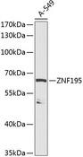 ZNF195 Antibody - Western blot analysis of extracts of A549 cells using ZNF195 Polyclonal Antibody at dilution of 1:1000.