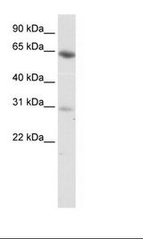 ZNF195 Antibody - Fetal Lung Lysate.  This image was taken for the unconjugated form of this product. Other forms have not been tested.