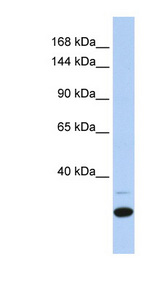 ZNF197 Antibody - ZNF197 antibody Western blot of Fetal Heart lysate. This image was taken for the unconjugated form of this product. Other forms have not been tested.