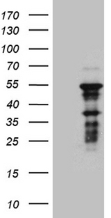ZNF2 Antibody - HEK293T cells were transfected with the pCMV6-ENTRY control. (Left lane) or pCMV6-ENTRY ZNF2. (Right lane) cDNA for 48 hrs and lysed