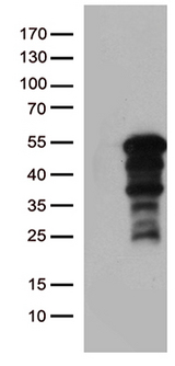 ZNF2 Antibody - HEK293T cells were transfected with the pCMV6-ENTRY control. (Left lane) or pCMV6-ENTRY ZNF2. (Right lane) cDNA for 48 hrs and lysed. Equivalent amounts of cell lysates. (5 ug per lane) were separated by SDS-PAGE and immunoblotted with anti-ZNF2. (1:2000)