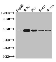 ZNF2 Antibody - Western Blot Positive WB detected in:HepG2 whole cell lysate,HL60 whole cell lysate,PC3 whole cell lysate,Mouse heart tissue,Mouse brain tissue All Lanes: ZNF2 antibody at 2.7ug/ml Secondary Goat polyclonal to rabbit IgG at 1/50000 dilution Predicted band size: 49,45 kDa Observed band size: 49 kDa