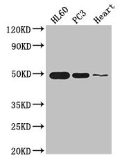 ZNF2 Antibody - Western Blot Positive WB detected in: HL60 whole cell lysate, PC-3 whole cell lysate, Mouse heart tissue All lanes: ZNF2 antibody at 2.7µg/ml Secondary Goat polyclonal to rabbit IgG at 1/50000 dilution Predicted band size: 49, 45 kDa Observed band size: 49 kDa