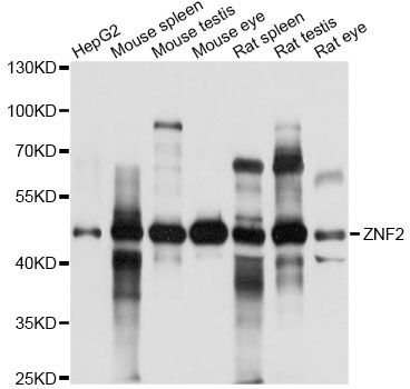 ZNF2 Antibody - Western blot analysis of extracts of various cell lines, using ZNF2 antibody at 1:1000 dilution. The secondary antibody used was an HRP Goat Anti-Rabbit IgG (H+L) at 1:10000 dilution. Lysates were loaded 25ug per lane and 3% nonfat dry milk in TBST was used for blocking. An ECL Kit was used for detection and the exposure time was 10s.