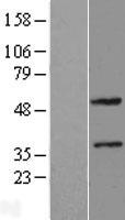 ZNF2 Protein - Western validation with an anti-DDK antibody * L: Control HEK293 lysate R: Over-expression lysate