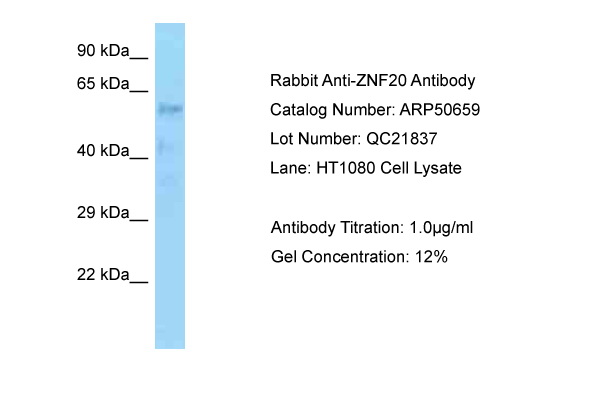ZNF20 Antibody -  This image was taken for the unconjugated form of this product. Other forms have not been tested.