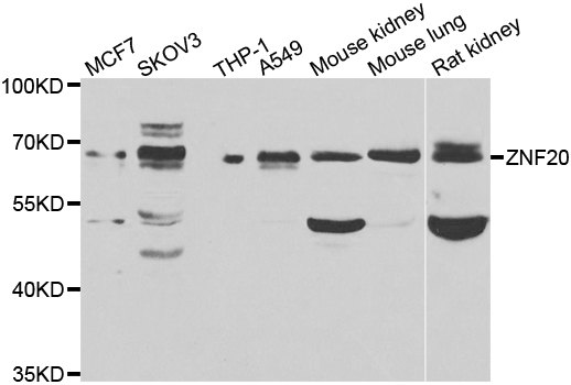 ZNF20 Antibody - Western blot analysis of extracts of various cell lines.