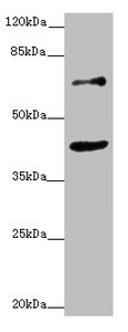 ZNF20 Antibody - Western blot All Lanes: ZNF20 antibody at 2.53ug/ml+ MCF7 whole cell lysate Goat polyclonal to rabbit at 1/10000 dilution Predicted band size: 62 kDa Observed band size: 62,40 kDa