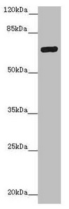ZNF20 Antibody - Western blot All Lanes: ZNF20 antibody at 2.99ug/ml+ Mouse kidney tissue Goat polyclonal to rabbit at 1/10000 dilution Predicted band size: 62 kDa Observed band size: 62 kDa