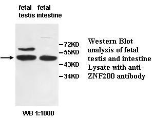 ZNF200 Antibody