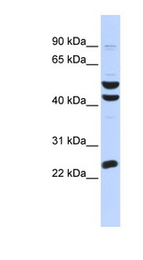 ZNF200 Antibody - ZNF200 antibody Western blot of OVCAR-3 cell lysate. This image was taken for the unconjugated form of this product. Other forms have not been tested.