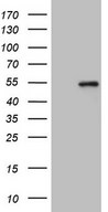 ZNF200 Antibody - HEK293T cells were transfected with the pCMV6-ENTRY control. (Left lane) or pCMV6-ENTRY ZNF200. (Right lane) cDNA for 48 hrs and lysed. Equivalent amounts of cell lysates. (5 ug per lane) were separated by SDS-PAGE and immunoblotted with anti-ZNF200. (1:2000)