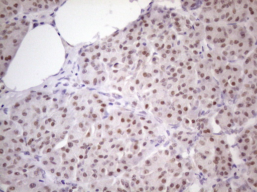 ZNF200 Antibody - Immunohistochemical staining of paraffin-embedded Human pancreas tissue within the normal limits using anti-ZNF200 mouse monoclonal antibody. (Heat-induced epitope retrieval by 1 mM EDTA in 10mM Tris, pH8.5, 120C for 3min. (1:150)