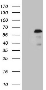 ZNF200 Antibody - HEK293T cells were transfected with the pCMV6-ENTRY control. (Left lane) or pCMV6-ENTRY ZNF200. (Right lane) cDNA for 48 hrs and lysed. Equivalent amounts of cell lysates. (5 ug per lane) were separated by SDS-PAGE and immunoblotted with anti-ZNF200. (1:2000)
