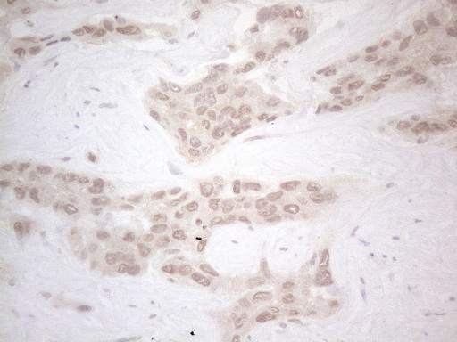 ZNF200 Antibody - Immunohistochemical staining of paraffin-embedded Human liver tissue within the normal limits using anti-ZNF200 mouse monoclonal antibody. (Heat-induced epitope retrieval by 1mM EDTA in 10mM Tris buffer. (pH8.5) at 120°C for 3 min. (1:150)