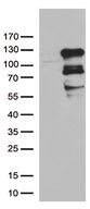 ZNF202 Antibody - HEK293T cells were transfected with the pCMV6-ENTRY control. (Left lane) or pCMV6-ENTRY ZNF202. (Right lane) cDNA for 48 hrs and lysed. Equivalent amounts of cell lysates. (5 ug per lane) were separated by SDS-PAGE and immunoblotted with anti-ZNF202. (1:500)