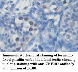 ZNF202 Antibody
