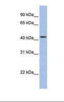 ZNF202 Antibody - Jurkat cell lysate. Antibody concentration: 1.0 ug/ml. Gel concentration: 12%.  This image was taken for the unconjugated form of this product. Other forms have not been tested.