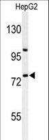 ZNF202 Antibody - Western blot of ZNF202 Antibody in HepG2 cell line lysates (35 ug/lane). ZNF202 (arrow) was detected using the purified antibody.