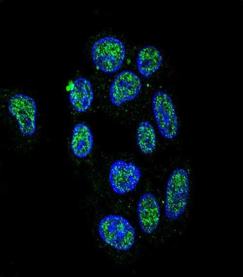 ZNF202 Antibody - Confocal immunofluorescence of ZNF202 Antibody with HepG2 cell followed by Alexa Fluor 488-conjugated goat anti-rabbit lgG (green). DAPI was used to stain the cell nuclear (blue).