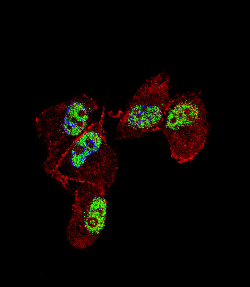 ZNF202 Antibody - Fluorescent confocal image of MDA-MB231 cell stained with ZNF202 Antibody. MDA-MB231 cells were fixed with 4% PFA (20 min), permeabilized with Triton X-100 (0.1%, 10 min), then incubated with ZNF202 primary antibody (1:25, 1 h at 37°C). For secondary antibody, Alexa Fluor 488 conjugated donkey anti-rabbit antibody (green) was used (1:400, 50 min at 37°C). Cytoplasmic actin was counterstained with Alexa Fluor 555 (red) conjugated Phalloidin (7units/ml, 1 h at 37°C). Nuclei were counterstained with DAPI (blue) (10 ug/ml, 10 min). ZNF202 immunoreactivity is localized to nucleus significantly.