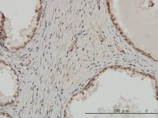 ZNF202 Antibody - Immunoperoxidase of monoclonal antibody to ZNF202 on formalin-fixed paraffin-embedded human prostate. [antibody concentration 3 ug/ml].