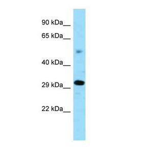 ZNF202 Antibody - Western blot of Mouse Kidney. Zfp202 antibody dilution 1.0 ug/ml.  This image was taken for the unconjugated form of this product. Other forms have not been tested.