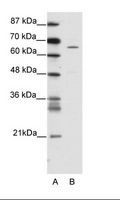 ZNF205 Antibody - A: Marker, B: Jurkat Cell Lysate.  This image was taken for the unconjugated form of this product. Other forms have not been tested.