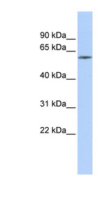 ZNF205 Antibody - ZNF205 antibody Western blot of SK-MEL-2 cell lysate. This image was taken for the unconjugated form of this product. Other forms have not been tested.