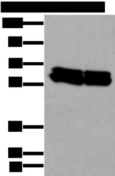 ZNF207 Antibody - Western blot analysis of HEPG2 and Hela cell lysates  using ZNF207 Polyclonal Antibody at dilution of 1:300