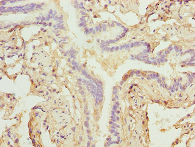 ZNF212 Antibody - Immunohistochemistry of paraffin-embedded human lung tissue using ZNF212 Antibody at dilution of 1:100