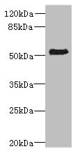 ZNF212 Antibody - Western blot All lanes: ZNF212 antibody at 8µg/ml + Mouse liver tissue Secondary Goat polyclonal to rabbit IgG at 1/10000 dilution Predicted band size: 55 kDa Observed band size: 55 kDa