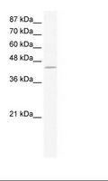 ZNF212 Antibody - K562 Cell Lysate.  This image was taken for the unconjugated form of this product. Other forms have not been tested.