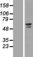 ZNF212 Protein - Western validation with an anti-DDK antibody * L: Control HEK293 lysate R: Over-expression lysate