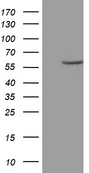 ZNF213 Antibody - HEK293T cells were transfected with the pCMV6-ENTRY control. (Left lane) or pCMV6-ENTRY ZNF213. (Right lane) cDNA for 48 hrs and lysed. Equivalent amounts of cell lysates. (5 ug per lane) were separated by SDS-PAGE and immunoblotted with anti-ZNF213. (1:200)