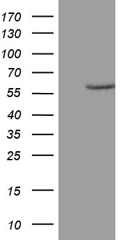 ZNF213 Antibody - HEK293T cells were transfected with the pCMV6-ENTRY control. (Left lane) or pCMV6-ENTRY ZNF213. (Right lane) cDNA for 48 hrs and lysed