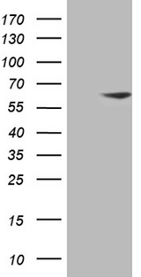 ZNF213 Antibody - HEK293T cells were transfected with the pCMV6-ENTRY control. (Left lane) or pCMV6-ENTRY ZNF213. (Right lane) cDNA for 48 hrs and lysed. Equivalent amounts of cell lysates. (5 ug per lane) were separated by SDS-PAGE and immunoblotted with anti-ZNF213. (1:500)
