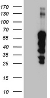 ZNF213 Antibody - HEK293T cells were transfected with the pCMV6-ENTRY control. (Left lane) or pCMV6-ENTRY ZNF213. (Right lane) cDNA for 48 hrs and lysed. Equivalent amounts of cell lysates. (5 ug per lane) were separated by SDS-PAGE and immunoblotted with anti-ZNF213. (1:2000)