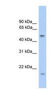ZNF213 Antibody - ZNF213 antibody Western blot of Fetal Muscle lysate. This image was taken for the unconjugated form of this product. Other forms have not been tested.