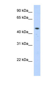 ZNF213 Antibody - ZNF213 antibody Western blot of Transfected 293T cell lysate. This image was taken for the unconjugated form of this product. Other forms have not been tested.