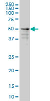 ZNF213 Antibody - ZNF213 monoclonal antibody (M01), clone 5D7 Western blot of ZNF213 expression in A-431.