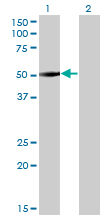 ZNF213 Antibody - Western blot of ZNF213 expression in transfected 293T cell line by ZNF213 monoclonal antibody (M01), clone 5D7.